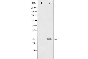 Western blot analysis of TNNI3 expression in Jurkat whole cell lysates,The lane on the left is treated with the antigen-specific peptide. (TNNI3 antibody  (N-Term))