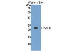 Western Blotting (WB) image for anti-Fibulin 5 (FBLN5) (AA 277-448) antibody (ABIN1858822) (Fibulin 5 antibody  (AA 277-448))
