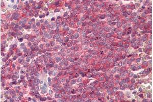 ABIN571213 (3. (SNAP23 antibody  (Internal Region))
