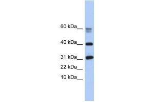 LOC339047 antibody used at 1 ug/ml to detect target protein. (LOC339047 antibody  (Middle Region))