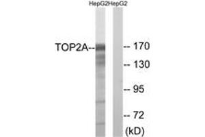 Western blot analysis of extracts from HepG2 cells, using TOP2A (Ab-1343) Antibody.