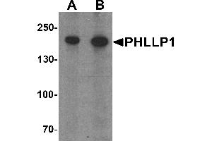 Western blot analysis of PHLPP1 in SW480 cell lysate with PHLPP1 antibody at (A) 1 and (B) 2 µg/mL. (PHLPP1 antibody  (N-Term))