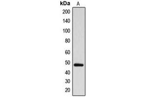 Western blot analysis of ARRDC1 expression in MDAMB231 (A) whole cell lysates. (ARRDC1 antibody  (Center))