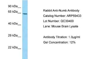Western Blotting (WB) image for anti-Numb Homolog (NUMB) (C-Term) antibody (ABIN2788064) (NUMB antibody  (C-Term))