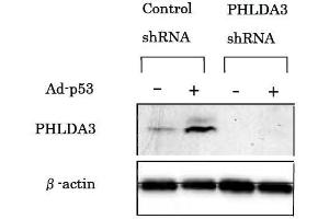 Western Blotting (WB) image for anti-Pleckstrin Homology-Like Domain, Family A, Member 3 (PHLDA3) (AA 1-31), (N-Term) antibody (ABIN2452076) (PHLDA3 antibody  (N-Term))