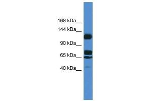 Western Blot showing ST5 antibody used at a concentration of 1.