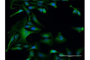 Immunofluorescence of purified MaxPab antibody to DAP3 on HeLa cell. (DAP3 antibody  (AA 1-398))