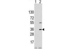Western Blotting (WB) image for anti-Signal Sequence Receptor, alpha (SSR1) antibody (ABIN2997994) (SSR1 antibody)