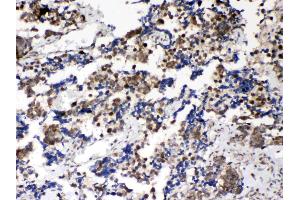 IHC analysis of Musashi 1/Msi1 using anti- Musashi 1/Msi1 antibody . (MSI1 antibody  (N-Term))
