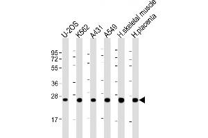 All lanes : Anti-UQCRFS1P1 Antibody (Center) at 1:2000 dilution Lane 1: U-2OS whole cell lysate Lane 2: K562 whole cell lysate Lane 3: A431 whole cell lysate Lane 4: A549 whole cell lysate Lane 5: human skeletal muscle lysate Lane 6: human placenta lysate Lysates/proteins at 20 μg per lane. (UQCRFS1P1 antibody  (AA 71-104))