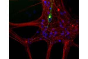Mixed neuron/glia cultures from newborn rat brain stained with MCA-7C5 antibody to peripherin (green) and rabbit polyclonal antibody to NF-L ABIN1842266 (red channel). (NEFL antibody)