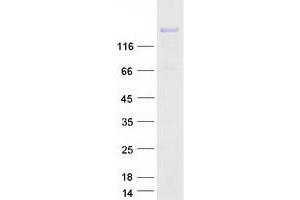 Validation with Western Blot (COL3A1 Protein (Myc-DYKDDDDK Tag))