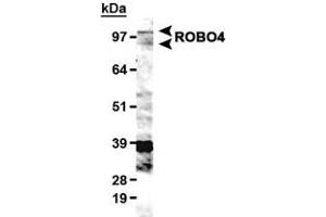 Western blot analysis of ROBO4 in HUVEC lysate with ROBO4 polyclonal antibody . (ROBO4 antibody  (AA 900-1007))
