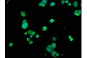 Immunofluorescence staining of PC-3 cells with ABIN7172586 at 1:200, counter-stained with DAPI. (NF-kB p65 antibody  (AA 1-210))