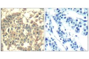 Image no. 2 for anti-Met Proto-Oncogene (MET) (AA 1001-1005) antibody (ABIN401652) (c-MET antibody  (AA 1001-1005))