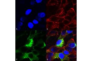 Immunocytochemistry/Immunofluorescence analysis using Mouse Anti-Nav beta3 Monoclonal Antibody, Clone S396-29 (ABIN2485591).