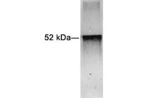 Western blot analysis of Glu-Glu-tag fusion protein using 1 µg/mL Rabbit Anti-Glu-Glu-tag Polyclonal Antibody (ABIN398451) The signal was developed with IRDyeTM 800 Conjugated Goat Anti-Rabbit IgG Antibody (Glu-Glu Tag antibody)