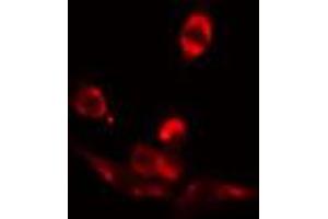 ABIN6272413 staining COLO205 by IF/ICC. (RFX3 antibody  (C-Term))