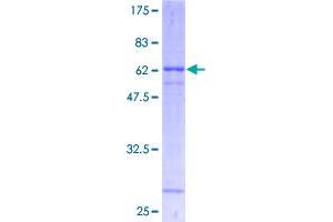 ATP1B1 Protein (AA 1-303) (GST tag)