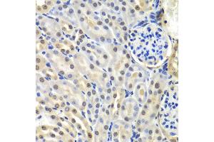 Immunohistochemistry of paraffin-embedded mouse kidney using SNRPD2 antibody at dilution of 1:100 (x40 lens). (SNRPD2 antibody)