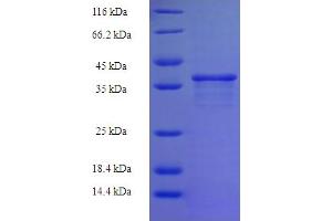 SDS-PAGE (SDS) image for Zinc Finger Protein 26 (ZNF26) (AA 335-533), (partial) protein (His-SUMO Tag) (ABIN4974799) (ZNF26 Protein (AA 335-533, partial) (His-SUMO Tag))