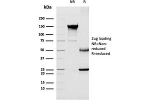 SDS-PAGE Analysis Purified CD40 Ligand Mouse Monoclonal Antibody (CD40LG/2763). (CD40 Ligand antibody  (AA 108-261))