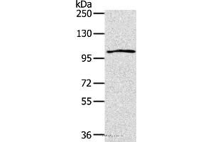 Western blot analysis of K562 cell, using IL17RA Polyclonal Antibody at dilution of 1:200 (IL17RA antibody)