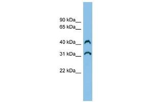 C3orf33 antibody used at 1 ug/ml to detect target protein. (C3orf33 antibody  (Middle Region))