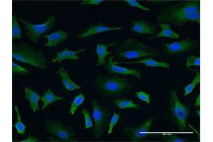Immunofluorescence of monoclonal antibody to USP9X on HeLa cell. (USP9X antibody  (AA 1-90))