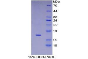 SDS-PAGE (SDS) image for Keratin 15 (KRT15) (AA 274-399) protein (His tag) (ABIN1099222) (KRT15 Protein (AA 274-399) (His tag))