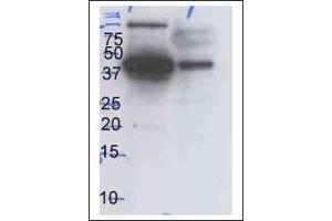 Western Blotting (WB) image for anti-Mitogen-Activated Protein Kinase 1/3 (MAPK1/3) antibody (ABIN371670) (ERK1/2 antibody)