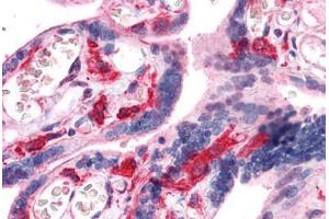 Human Placenta: Formalin-Fixed, Paraffin-Embedded (FFPE) (HCLS1 antibody  (AA 266-356))