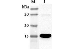 Western blot analysis using anti-FABP4 (human), pAb  at 1:2'000 dilution. (FABP4 antibody)