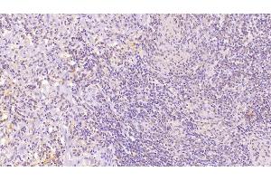 Detection of CD97 in Human Spleen Tissue using Monoclonal Antibody to Cluster Of Differentiation 97 (CD97) (CD97 antibody  (AA 58-260))