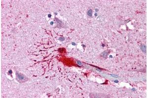 Human Brain, Cortex: Formalin-Fixed, Paraffin-Embedded (FFPE) (LHX8 antibody  (AA 1-321))