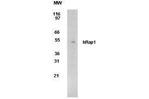 Image no. 1 for anti-Telomeric Repeat Binding Factor 2, Interacting Protein (TERF2IP) (AA 212-235) antibody (ABIN208205) (RAP1 antibody  (AA 212-235))