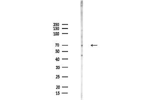 anti-Glutamine-Fructose-6-Phosphate Transaminase 2 (GFPT2) antibody