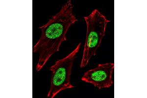 Fluorescent image of Hela cells stained with MGMT Antibody B. (MGMT antibody)