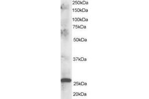 Image no. 1 for anti-ClpP Caseinolytic Peptidase, ATP-Dependent, Proteolytic Subunit Homolog (E. Coli) (CLPP) (C-Term) antibody (ABIN374308) (CLPP antibody  (C-Term))