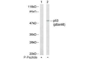 Image no. 1 for anti-Tumor Protein P53 (TP53) (pSer46) antibody (ABIN196787) (p53 antibody  (pSer46))