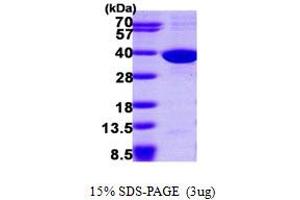 SDS-PAGE (SDS) image for Sulfotransferase Family, Cytosolic, 1C, Member 2 (SULT1C2) (AA 1-296) protein (His tag) (ABIN667302)