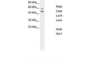 Image no. 2 for anti-GC-Rich Promoter Binding Protein 1 (GPBP1) (AA 67-116) antibody (ABIN6736275) (GC-Rich Promoter Binding Protein 1 (GPBP1) (AA 67-116) antibody)