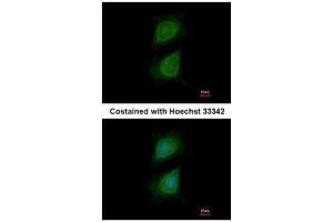 ICC/IF Image Immunofluorescence analysis of methanol-fixed HeLa, using Plexin D1, antibody at 1:500 dilution.