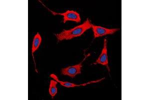 Immunofluorescent analysis of Collagen 1 alpha 2 staining in HeLa cells. (COL1A2 antibody  (N-Term))