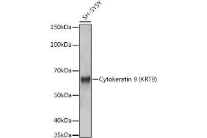 Western blot analysis of extracts of SH-SY5Y cells, using Cytokeratin 9 (KRT9) (KRT9) antibody (ABIN7268107) at 1:1000 dilution. (KRT9 antibody)