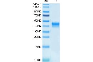 CD25 Protein (AA 22-213) (His-Avi Tag,Biotin)