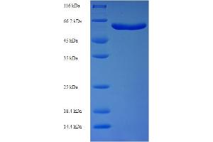 SDS-PAGE (SDS) image for Syntaphilin (SNPH) (AA 1-424), (partial) protein (His-SUMO Tag) (ABIN4976568)