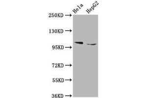 Western Blot Positive WB detected in: Hela whole cell lysate, HepG2 whole cell lysate All lanes: IKBKAP antibody at 5. (IKAP/p150 antibody  (AA 1107-1258))