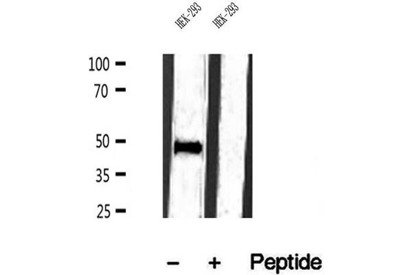 IFT57 antibody  (Internal Region)