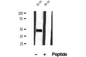 Western blot analysis of extracts of HEK-293 cells, using IFT57 antibody. (IFT57 antibody  (Internal Region))